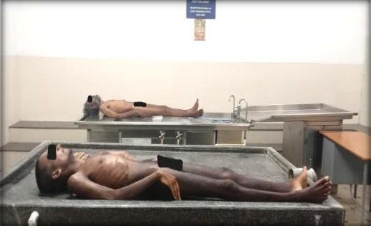 Autopsy
